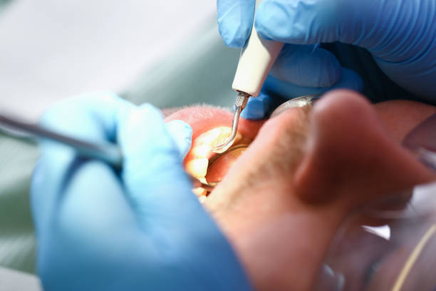 Best Emergency Dental Extractions in Sharpsburg, PA